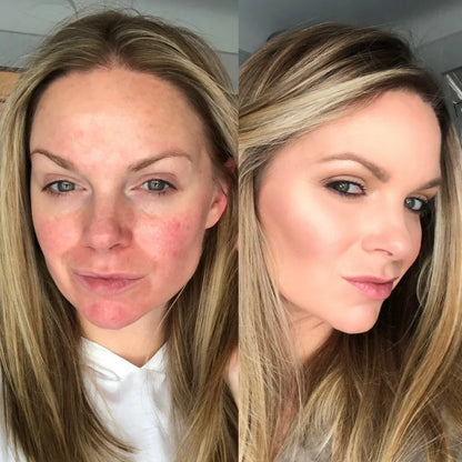 Base de Maquillaje Antiedad con SPF 50 – Se Adapta a tu Tono de Piel